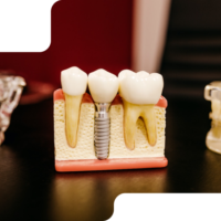 Fake teeth