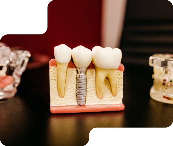 Fake teeth